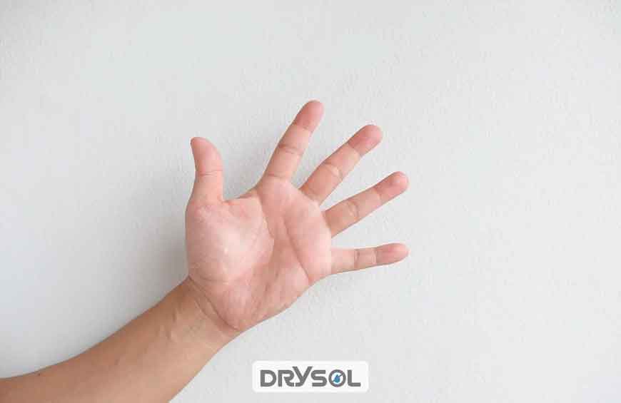 درایسول - دلیل عرق دست چیست؟